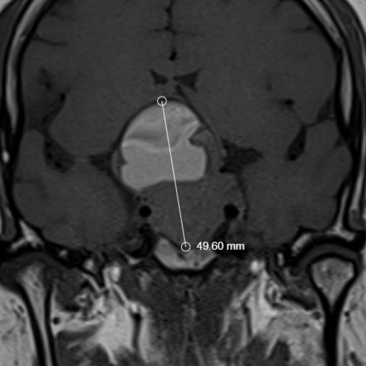 David Tafur Muñoz-1747