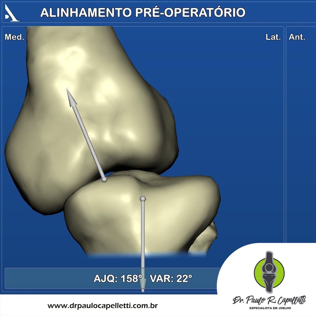 Paulo Roberto Capelletti-74