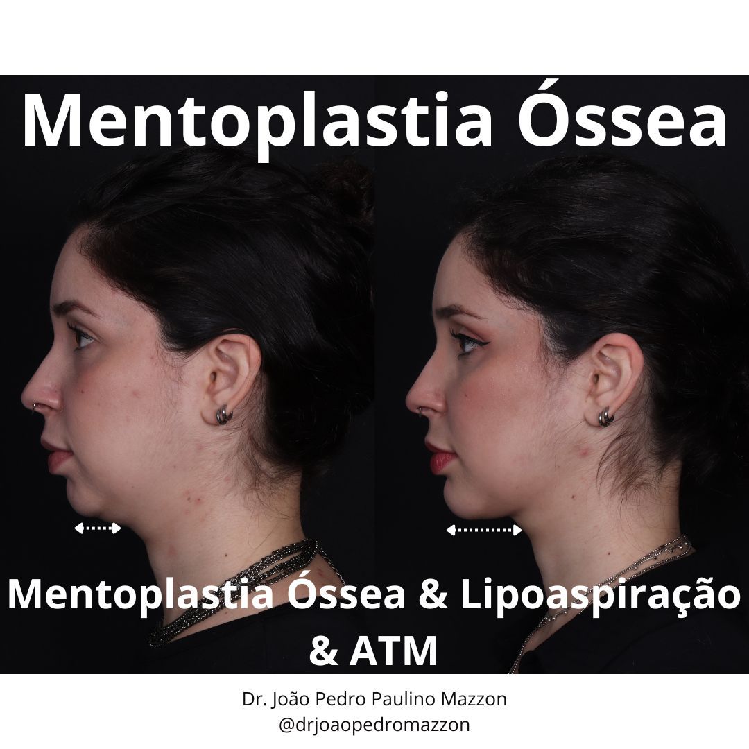 João Pedro Paulino Mazzon-21