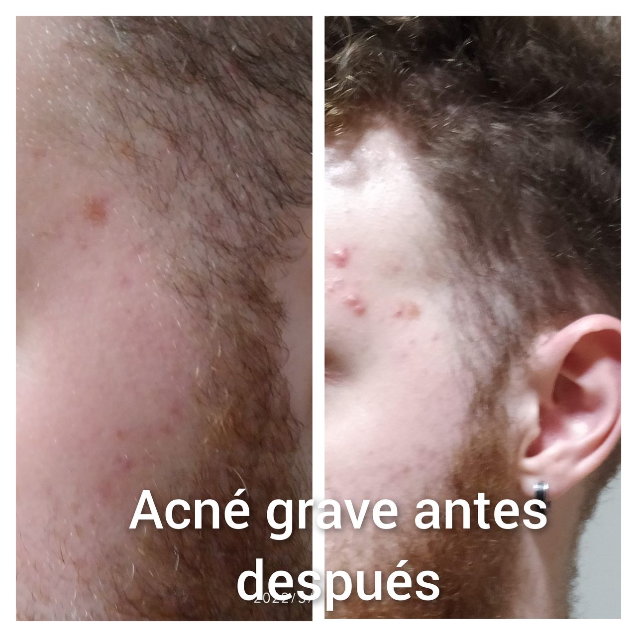 Alejandra Meijide-16