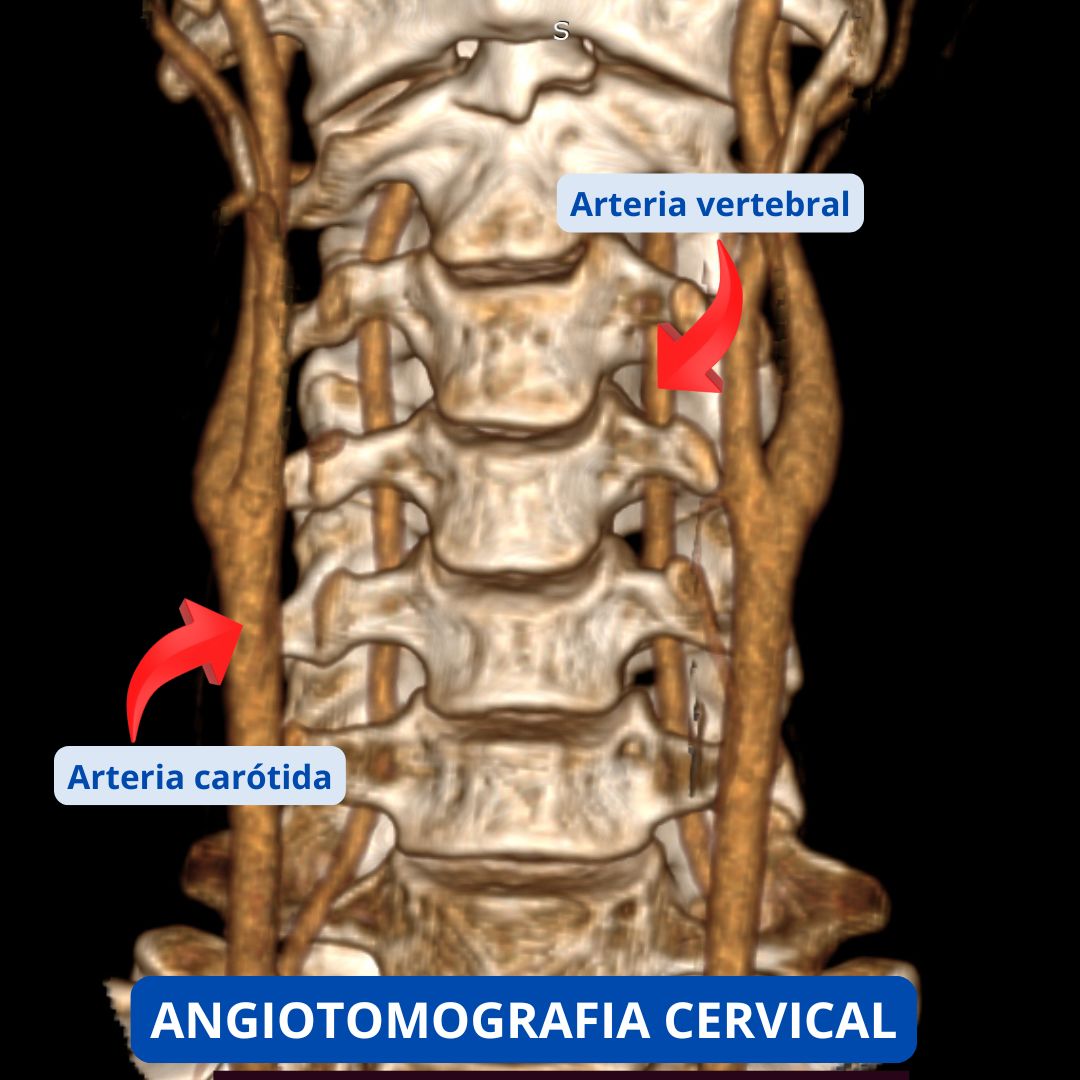David Tafur Muñoz-2267
