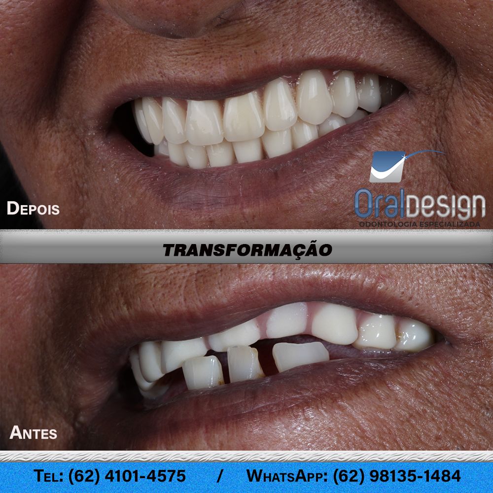 Danilo Monteiro Rezende Pereira-7