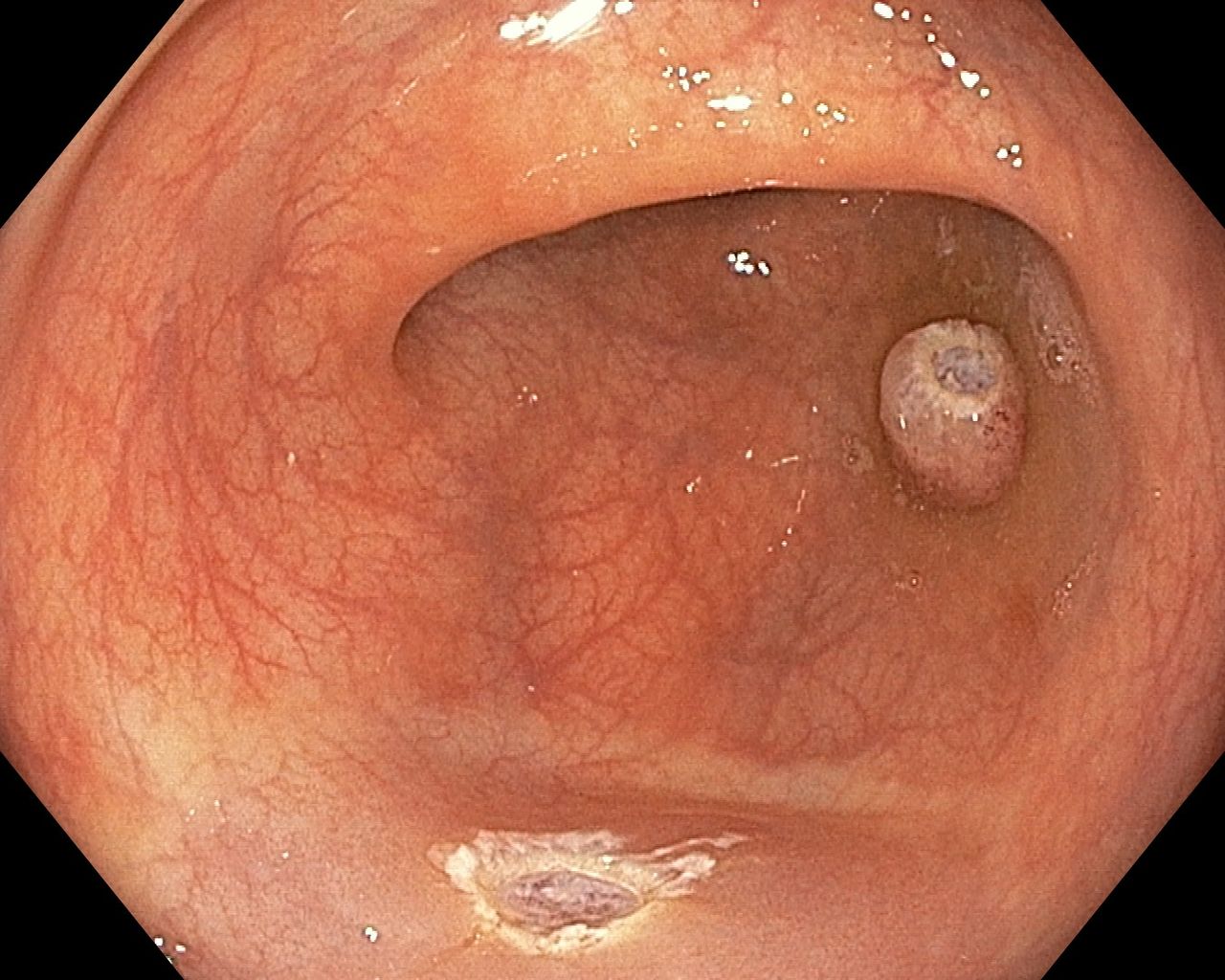 Hernán Del Carpio Zeballos-4