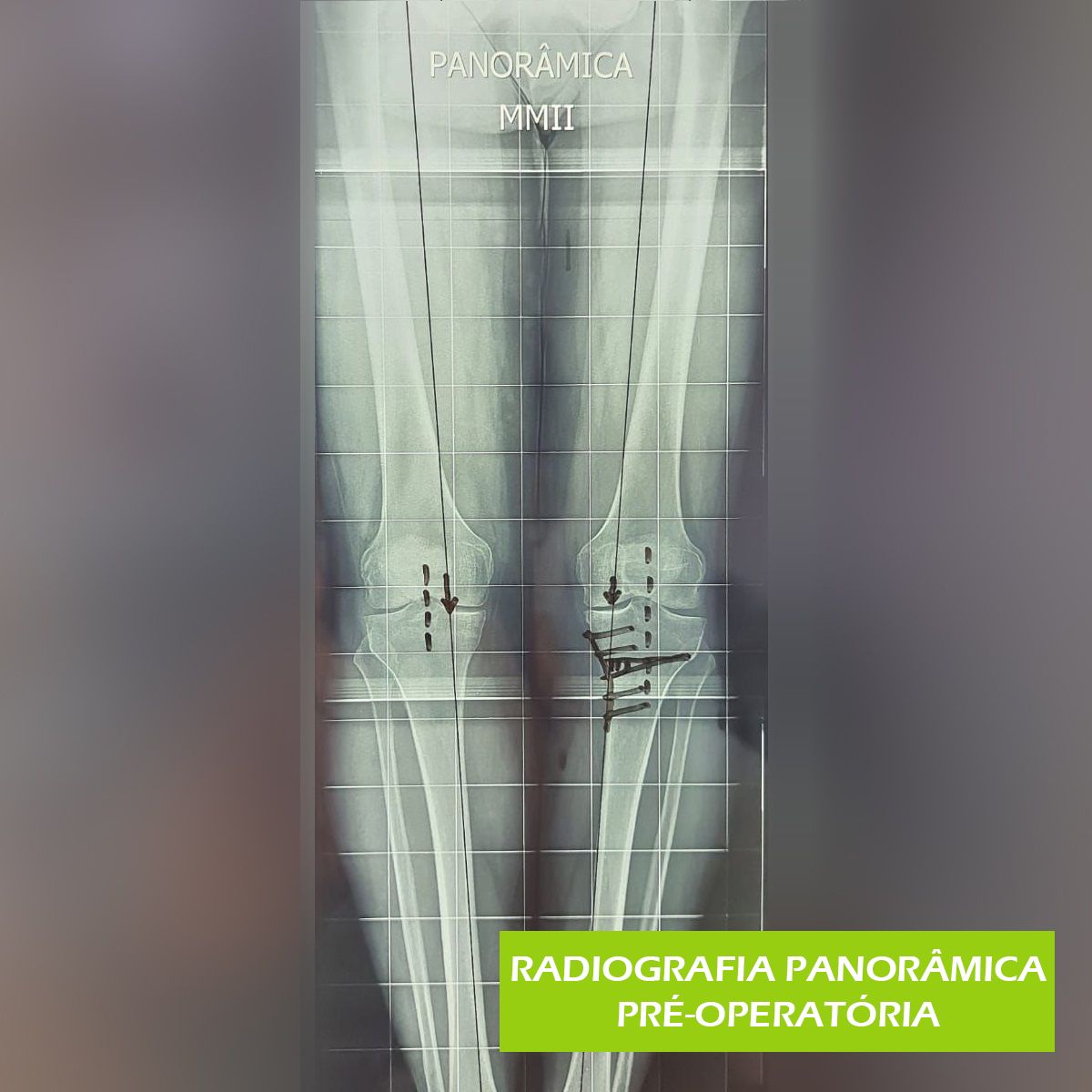 Paulo Roberto Capelletti-44