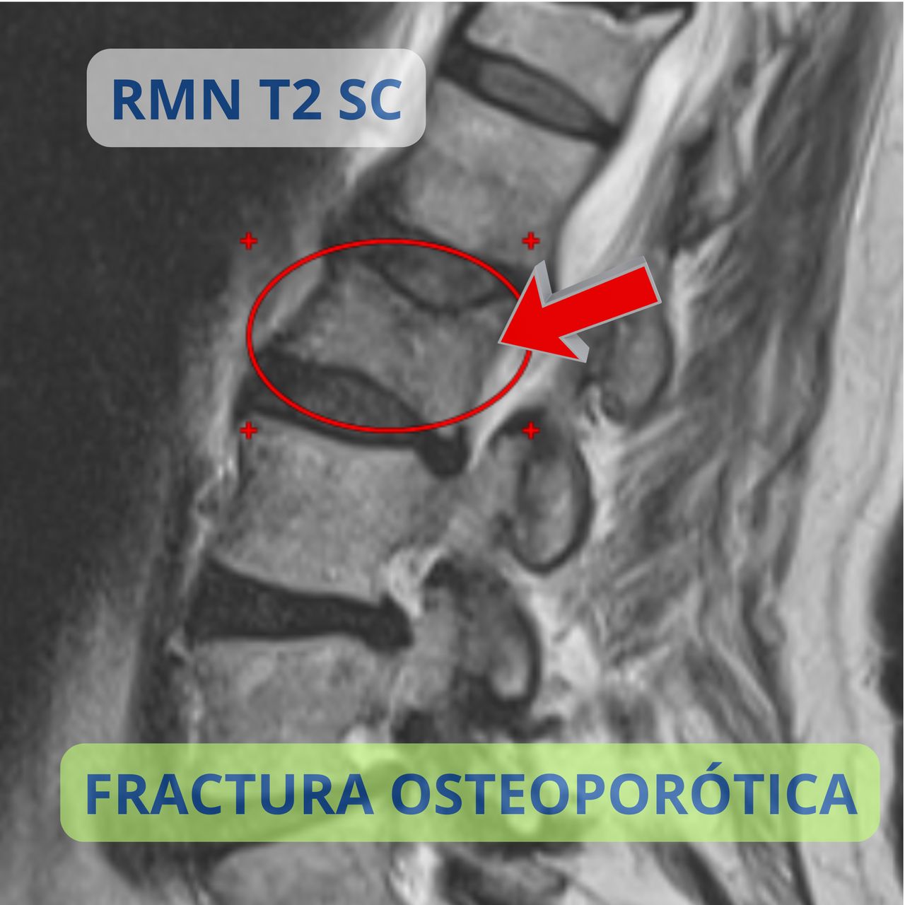 David Tafur Muñoz-2176