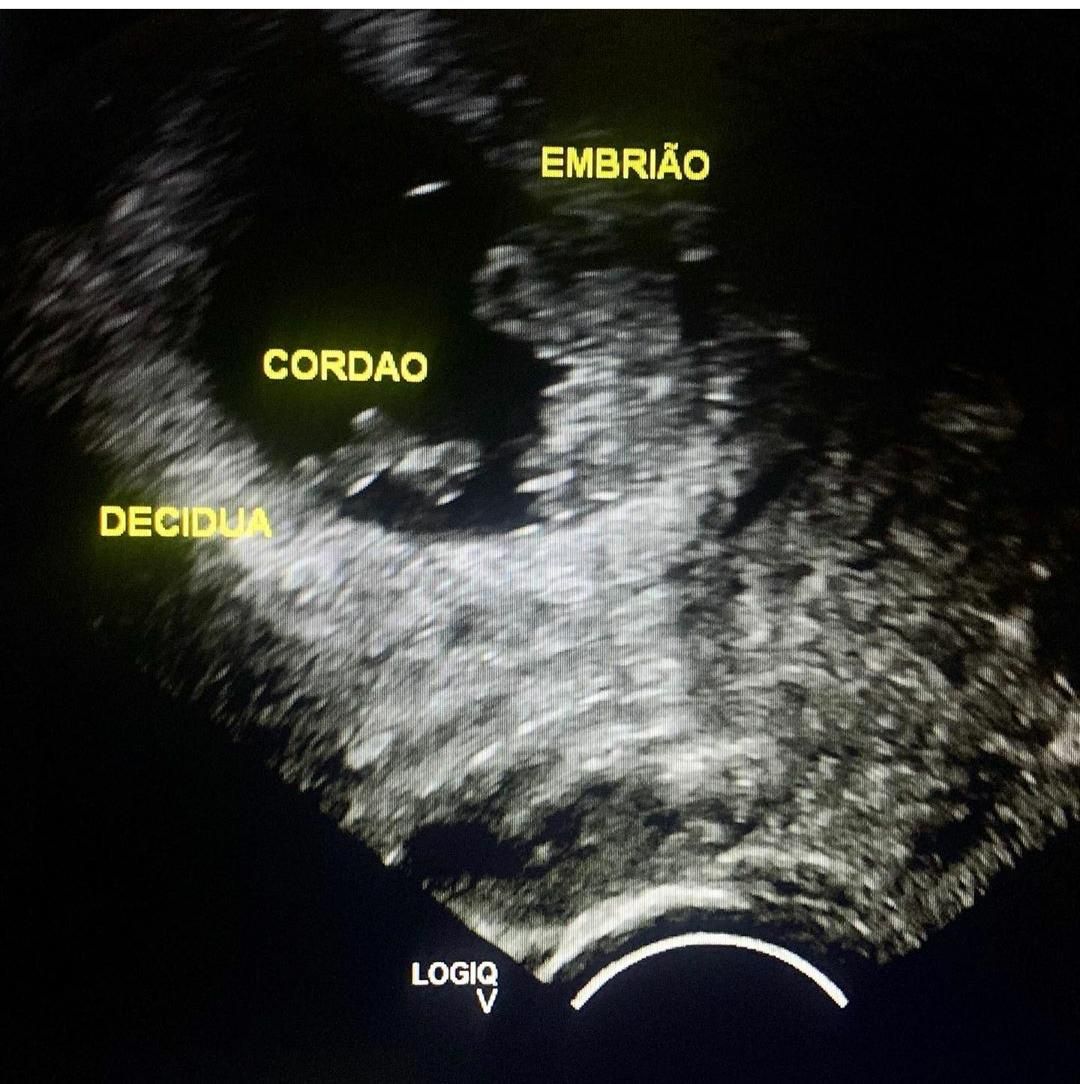 Lyzianne Neves Bona-13