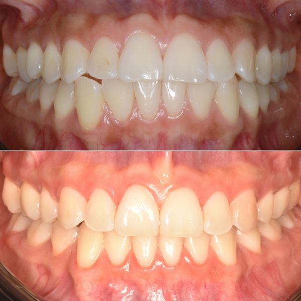 Frank Mendoza Alanya-20