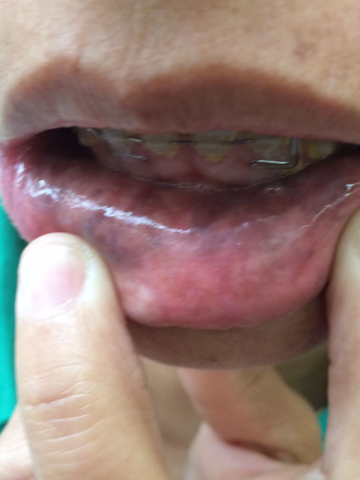 Francisco De Assis Almeida Lima Júnior-19