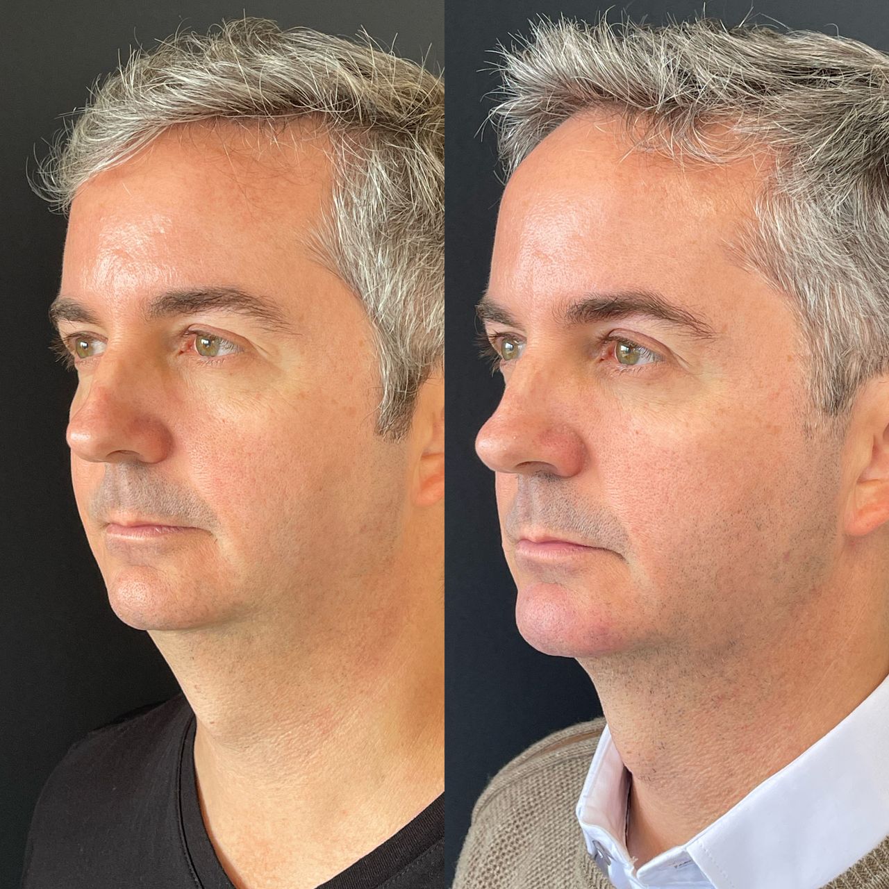 Gisele De Carvalho Versannio-24