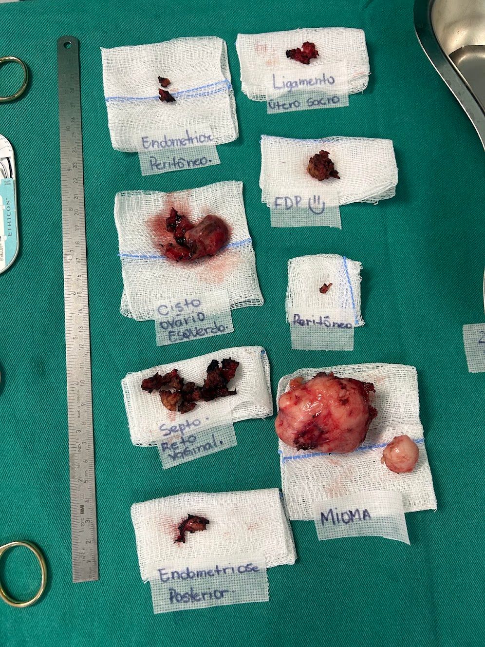 Adalberto Cesario Pereira Junior-15