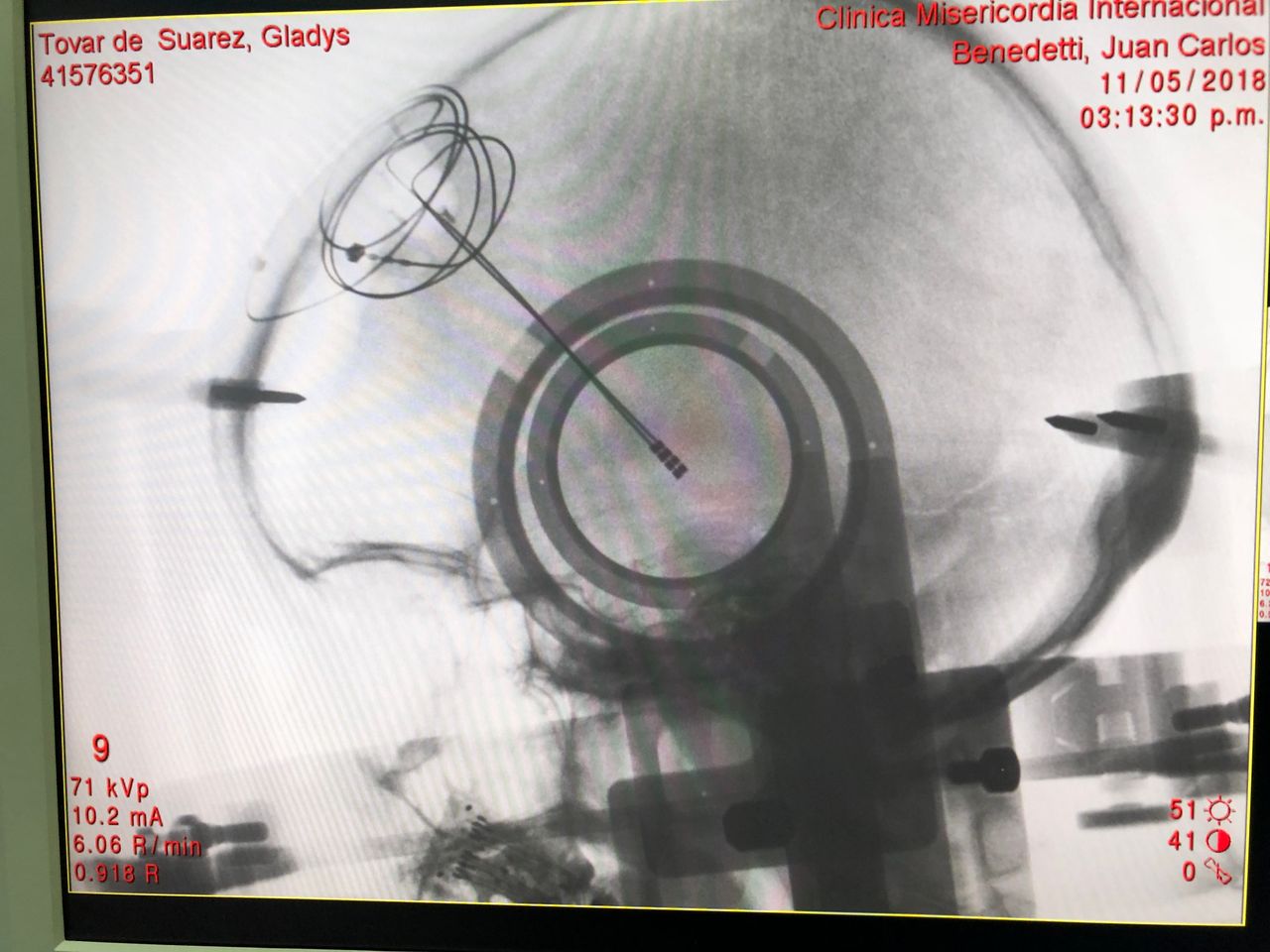 Juan Carlos Benedetti Isaac-6