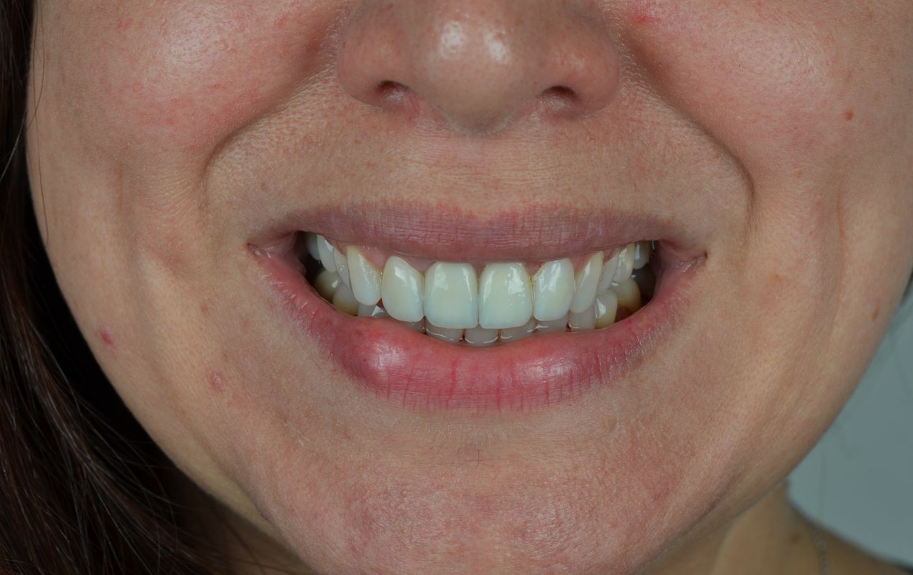 Luciano Varas Salinas-39