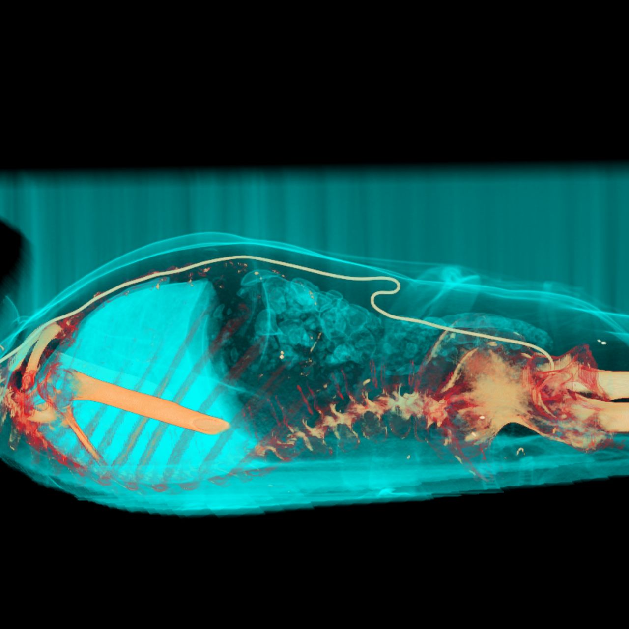 David Tafur Muñoz-1345