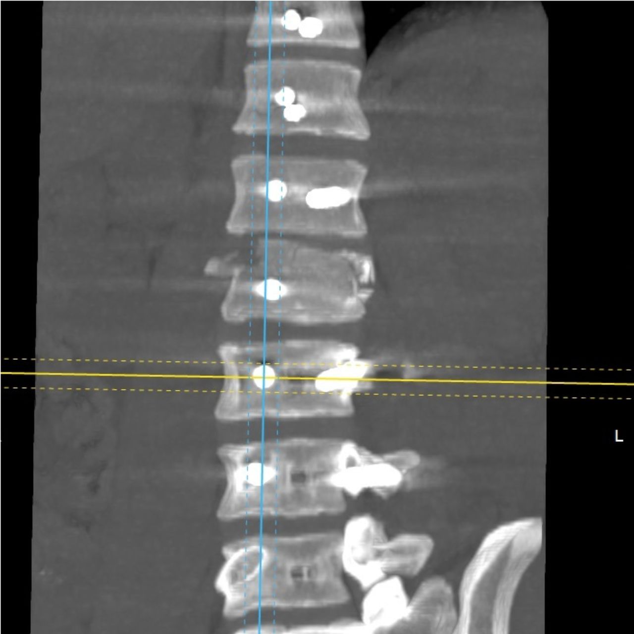 David Tafur Muñoz-1536