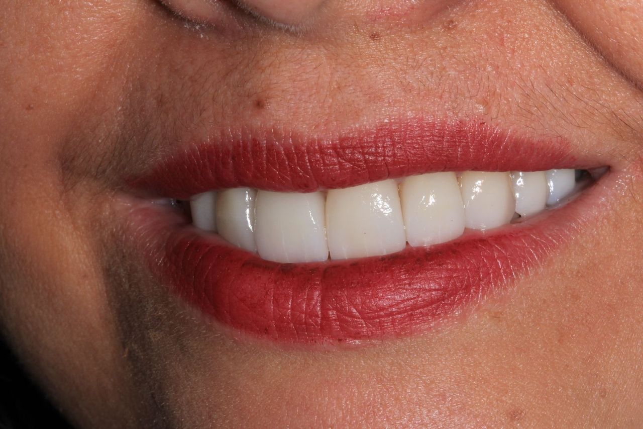 Lidiane Morais Mendes-10