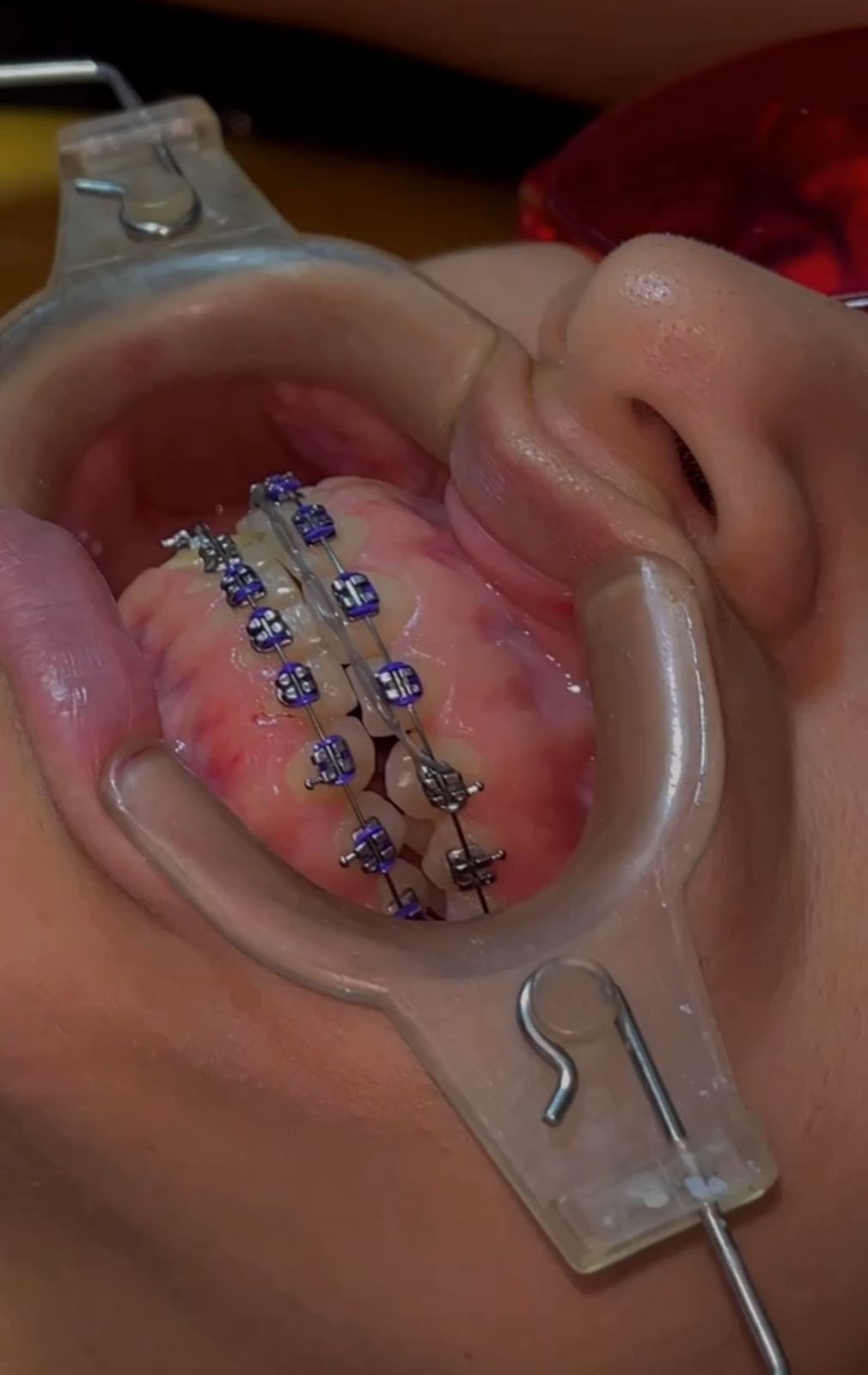 Joel Anderson Valverde Rebaza-0