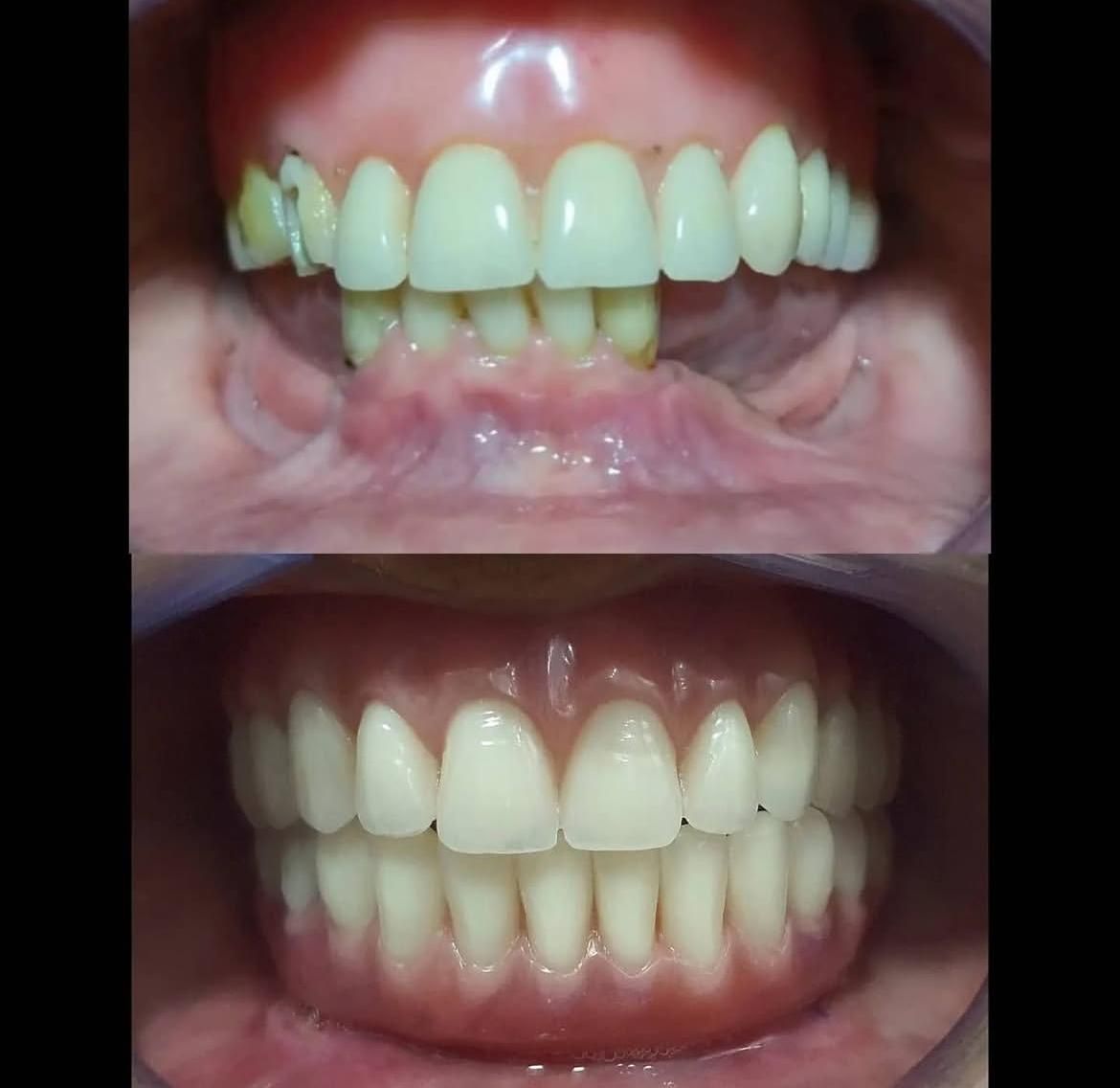 Almirando Eugenio De Lima Junior-1