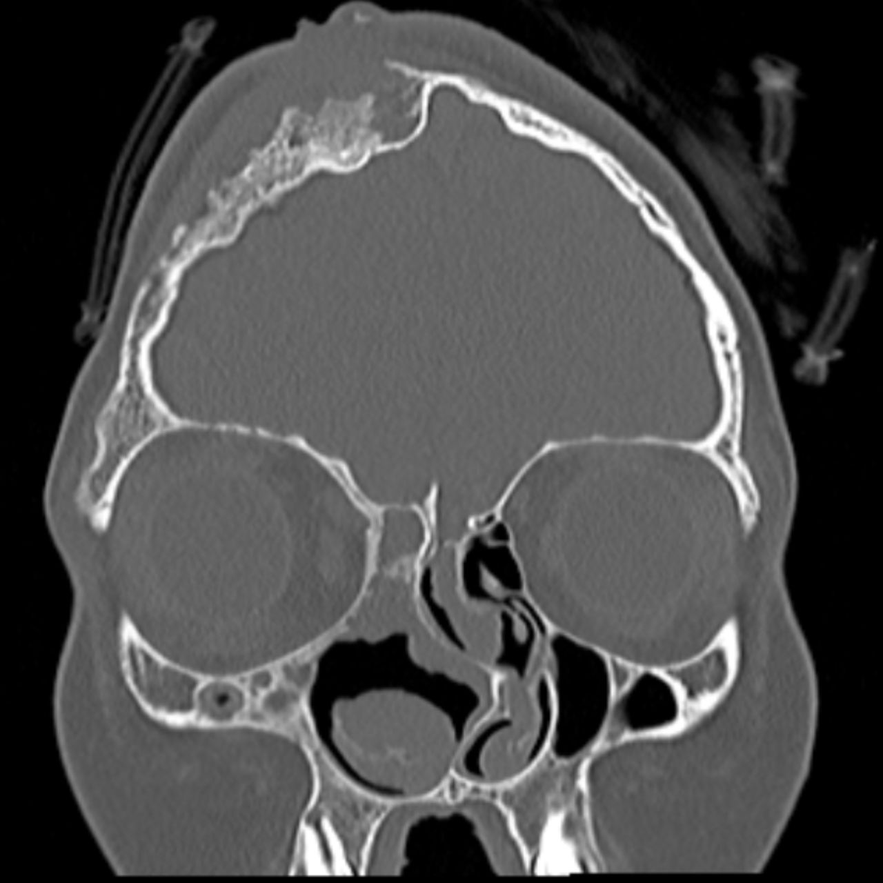 David Tafur Muñoz-1719