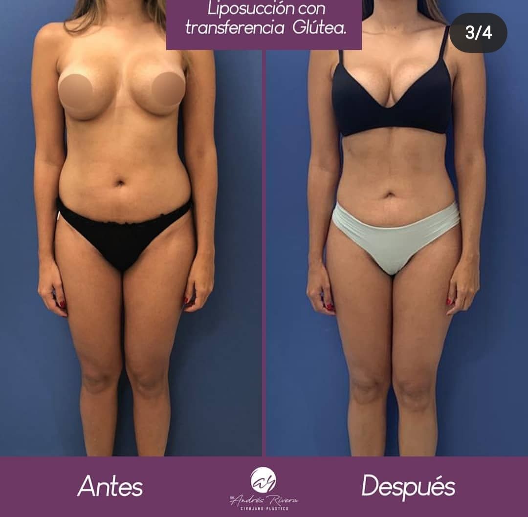 Andrés Rivera López-36