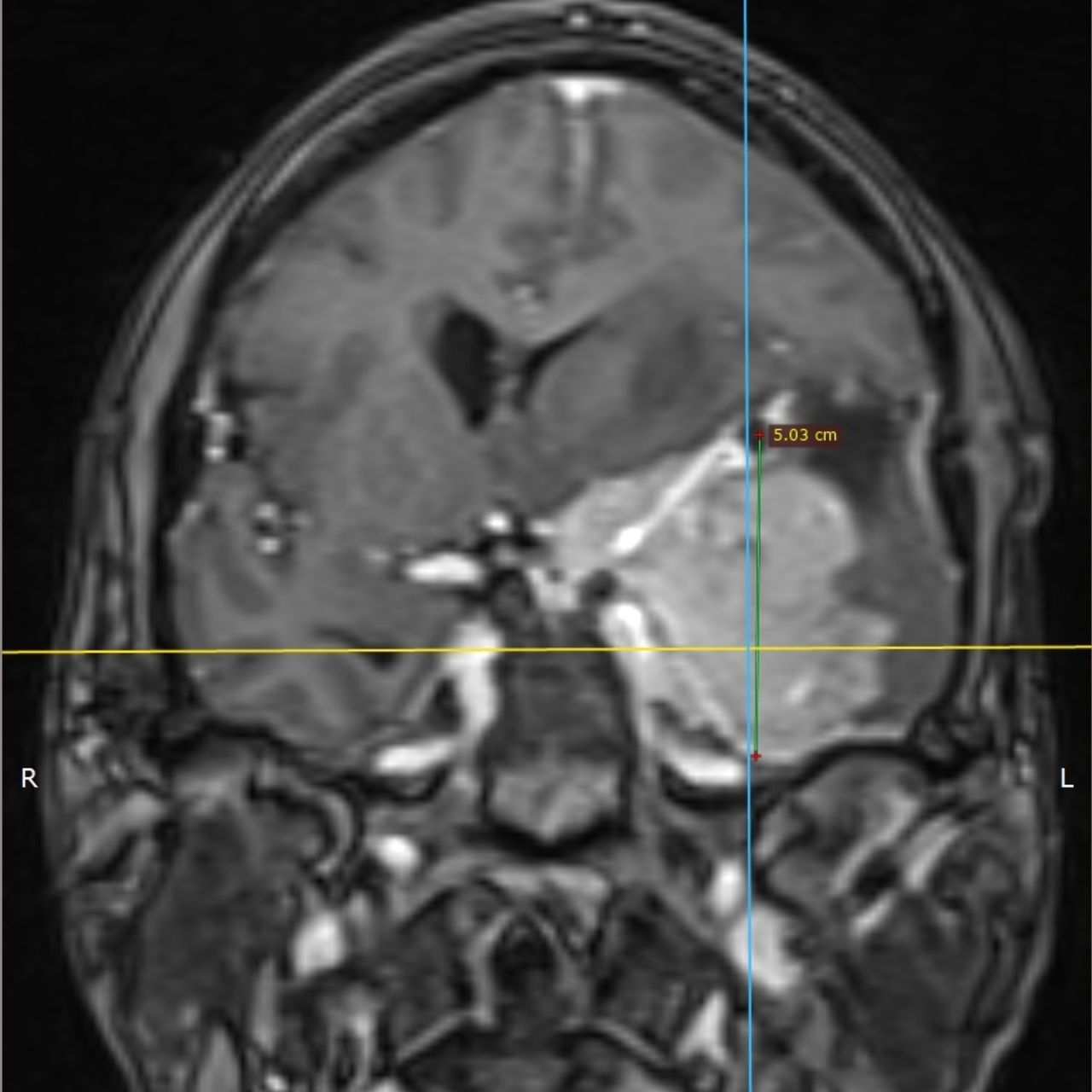 David Tafur Muñoz-1526