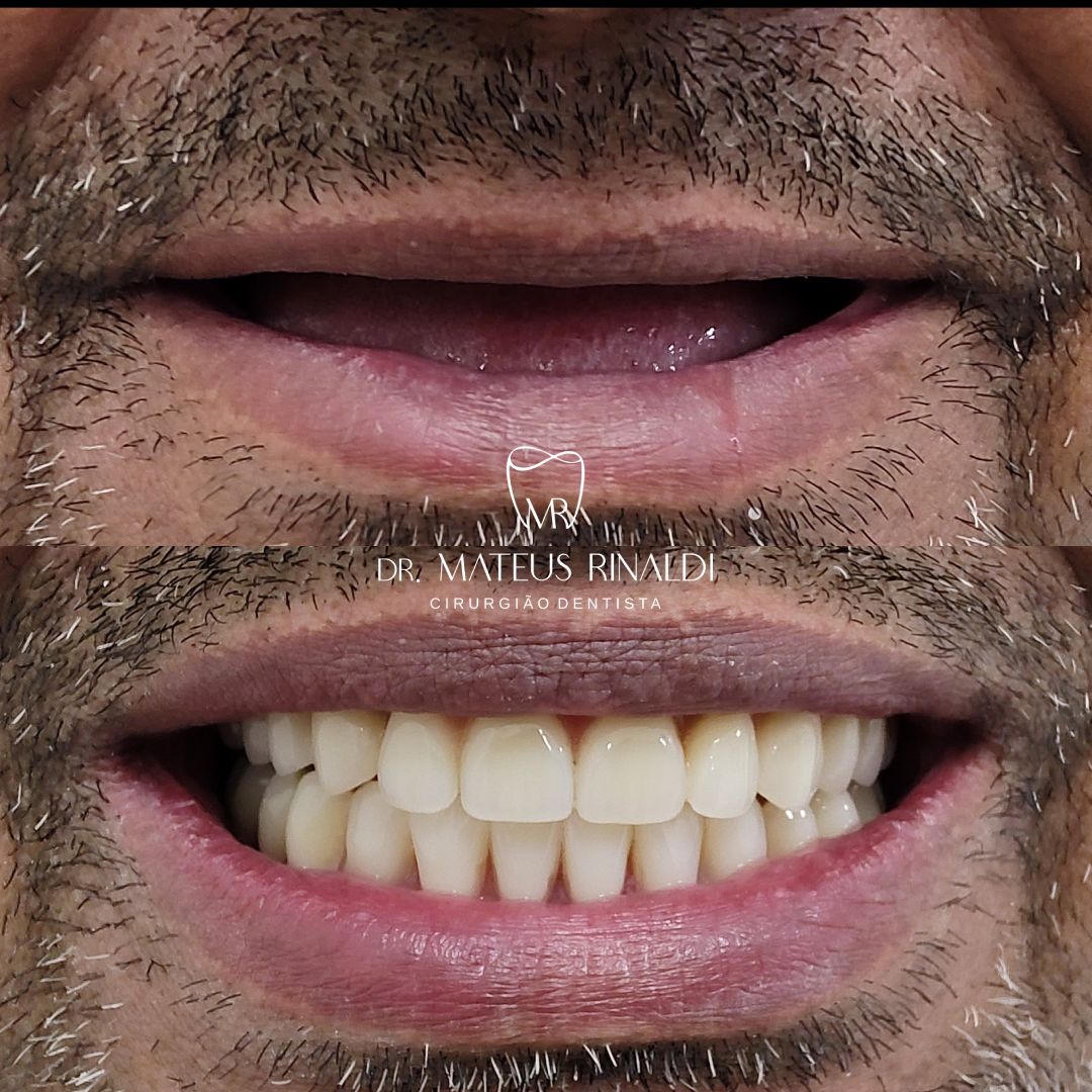 Mateus Rinaldi Lucio Martins-10