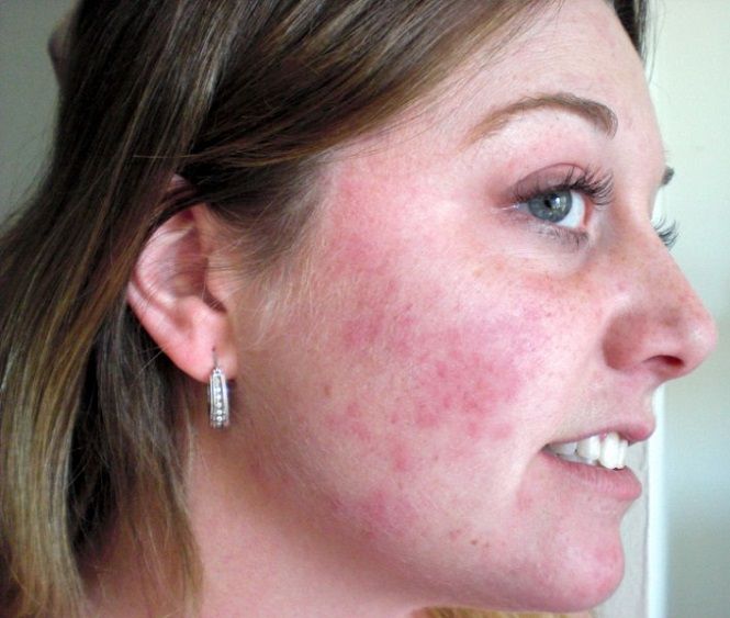 Antonio Carlos Biel-15