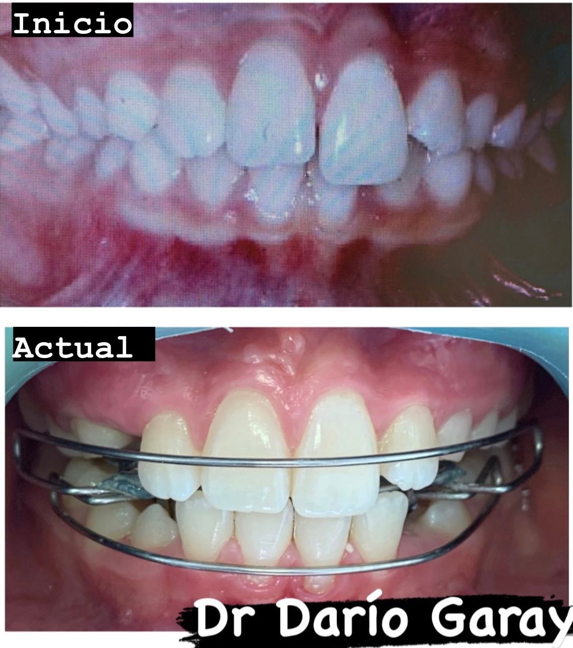 Dario Antonio Garay Chaustre-10