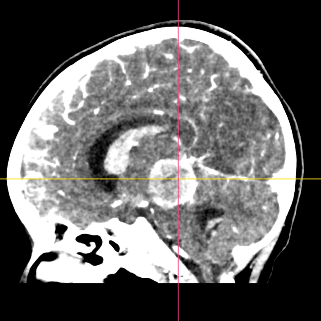 David Tafur Muñoz-1825