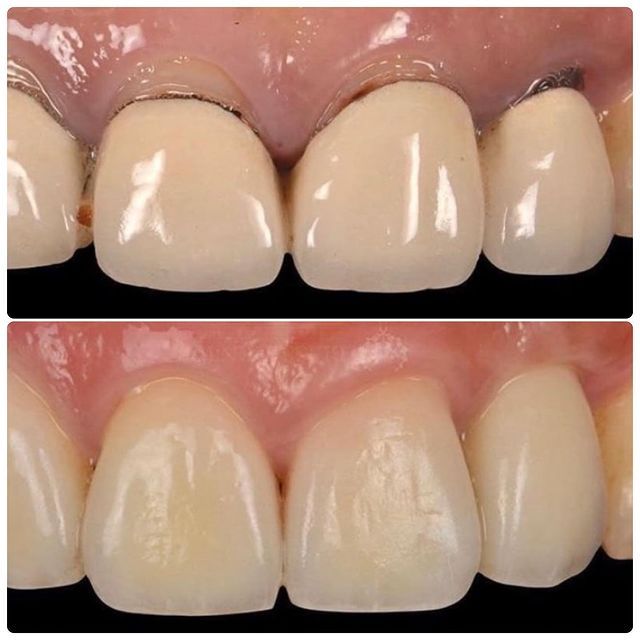 Leandro Ponte Dias-17