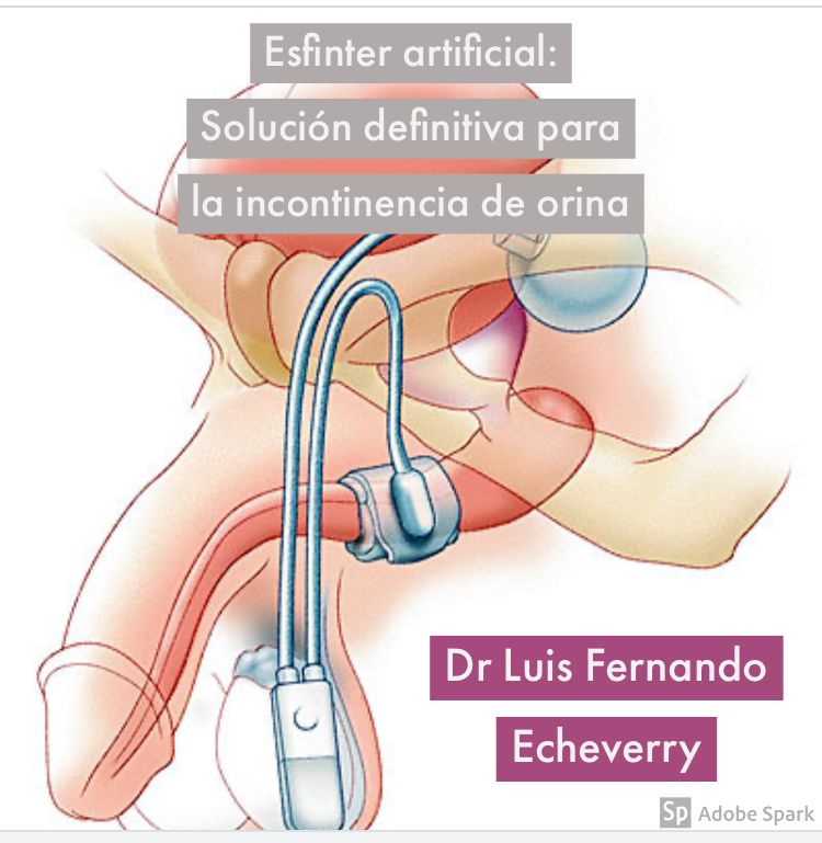 Luis Fernando Echeverry Molina-5