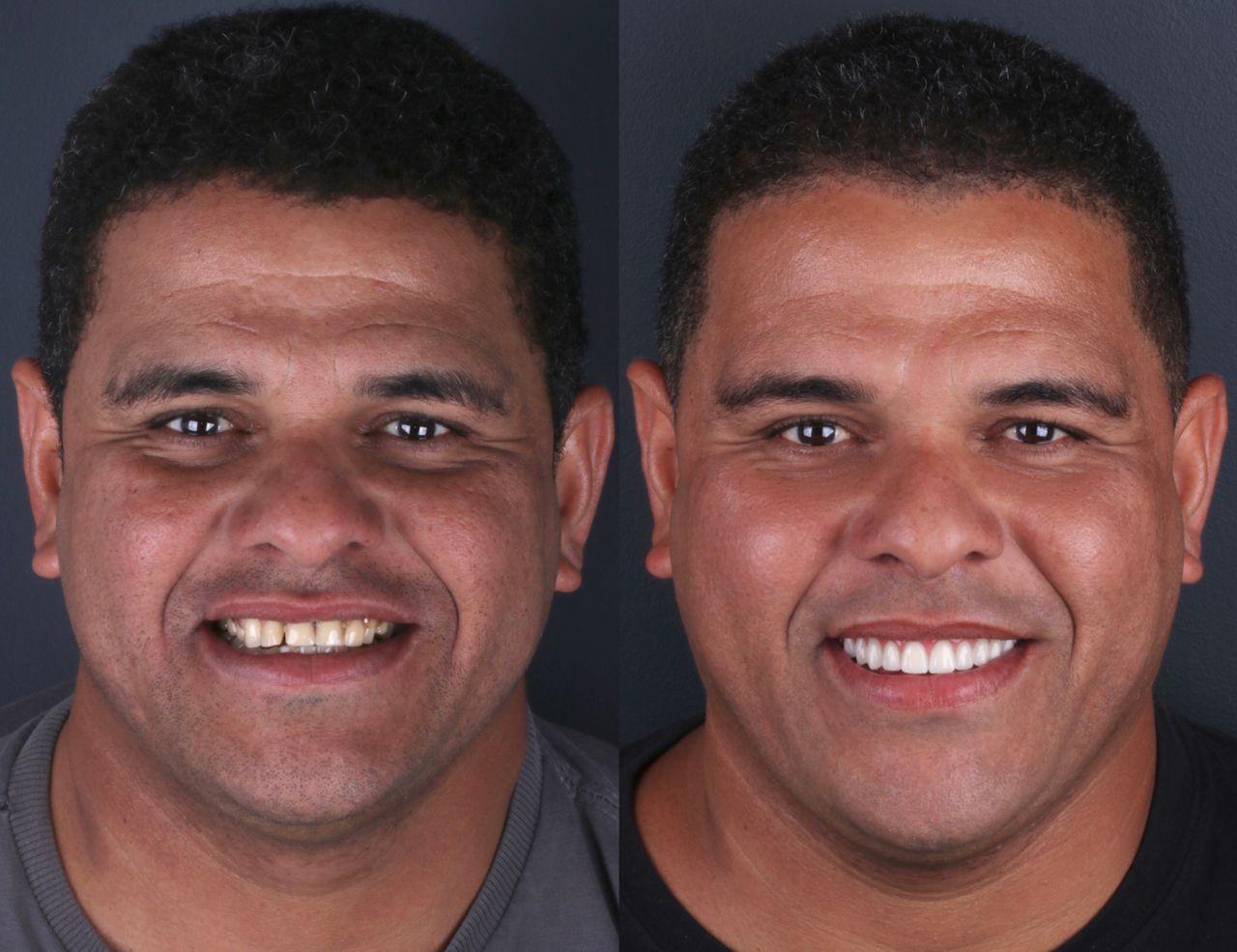 Daniel De Souza Pereira-9