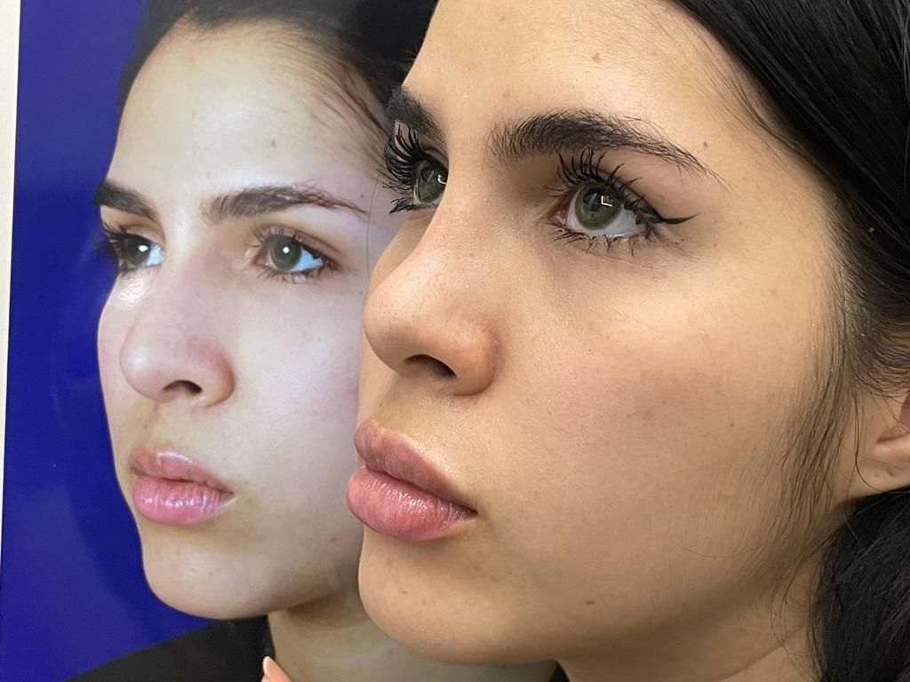 Boris Humberto Cespedes Polo-10