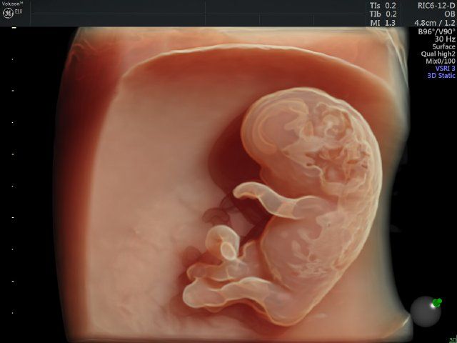 Raul Javier Banderas Pumarino-14