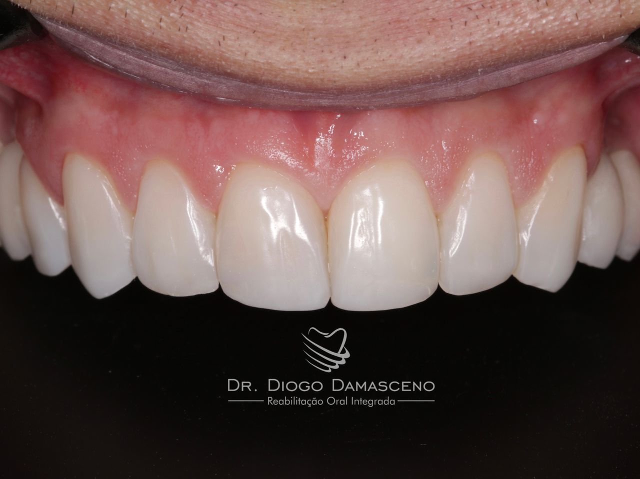 Diogo Damasceno-59