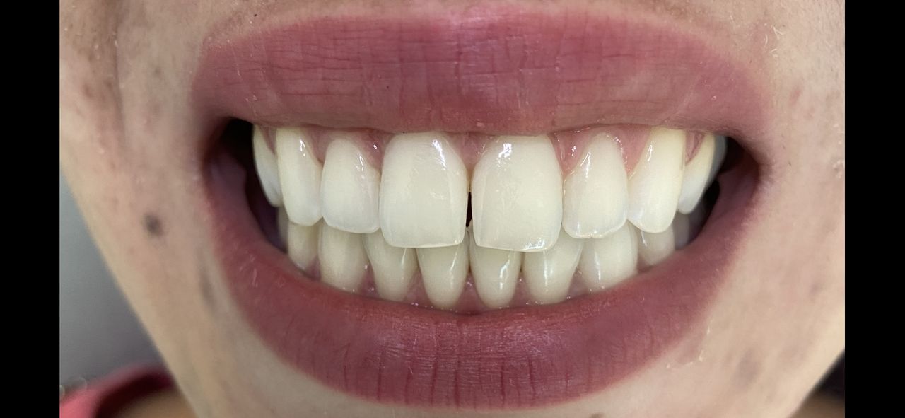 Antônio Alegria Do Nascimento-10