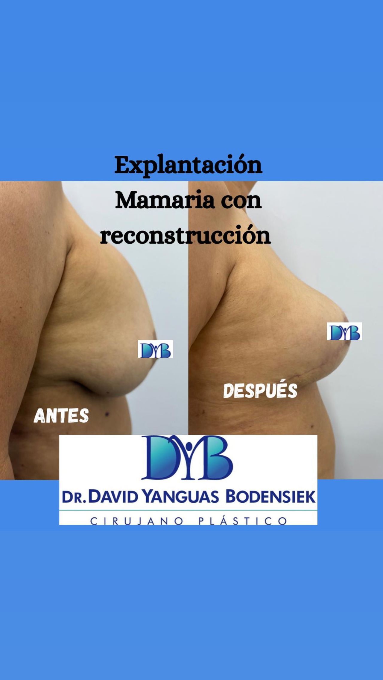 David Yanguas Bodensiek-3