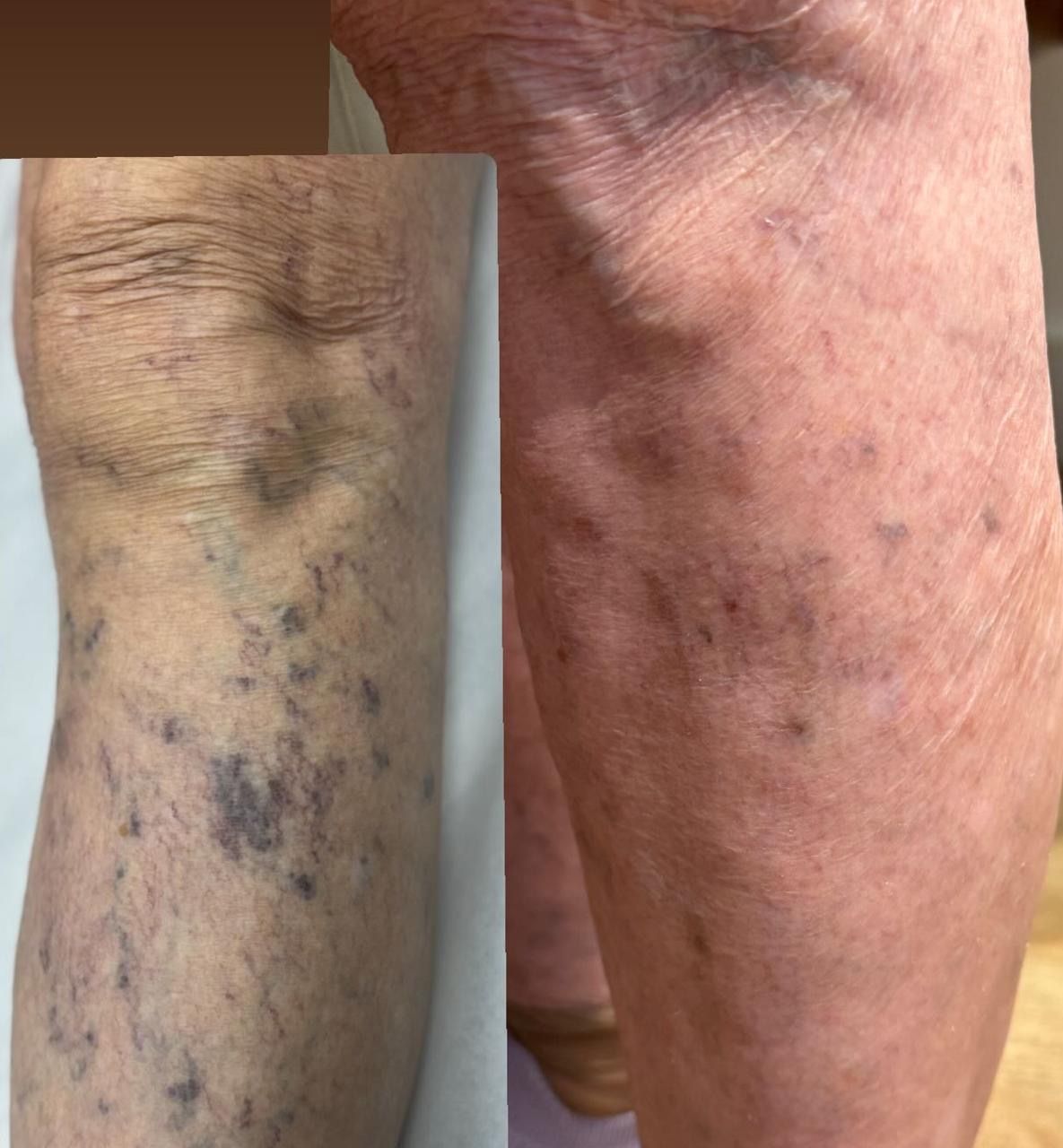 Emilia Alves Bento-1