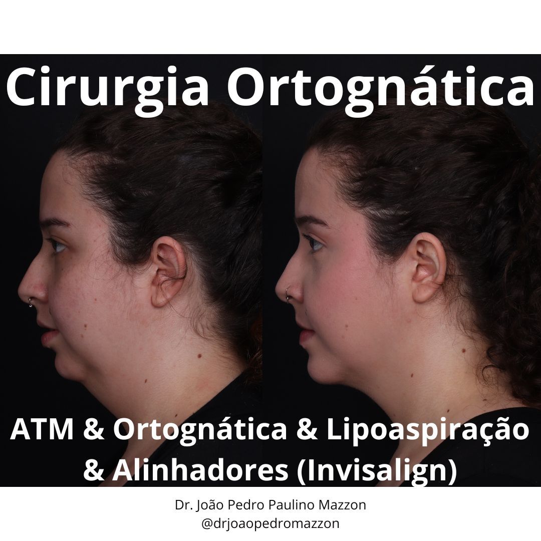 João Pedro Paulino Mazzon-27