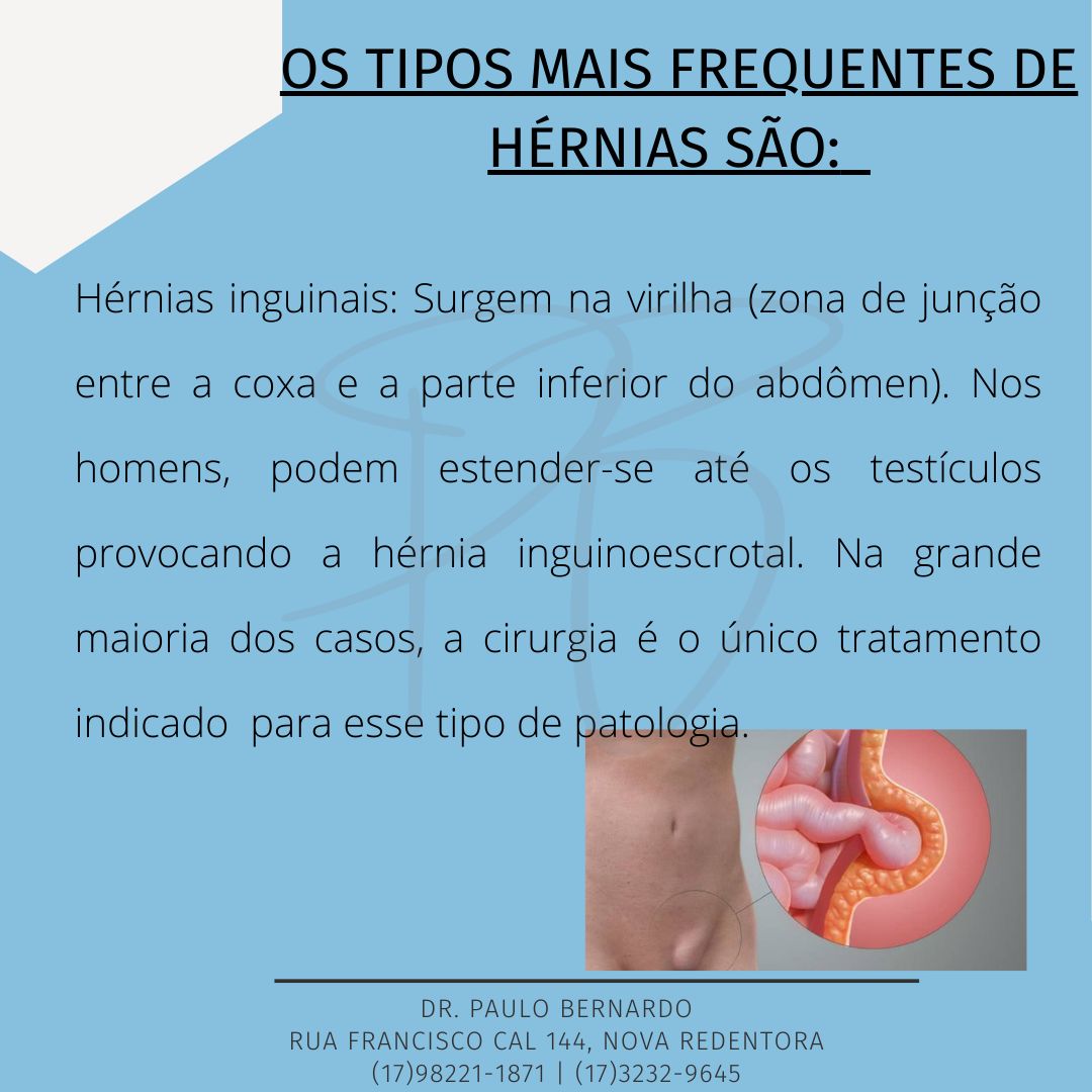 Paulo Leandro Alves Bernardo-6