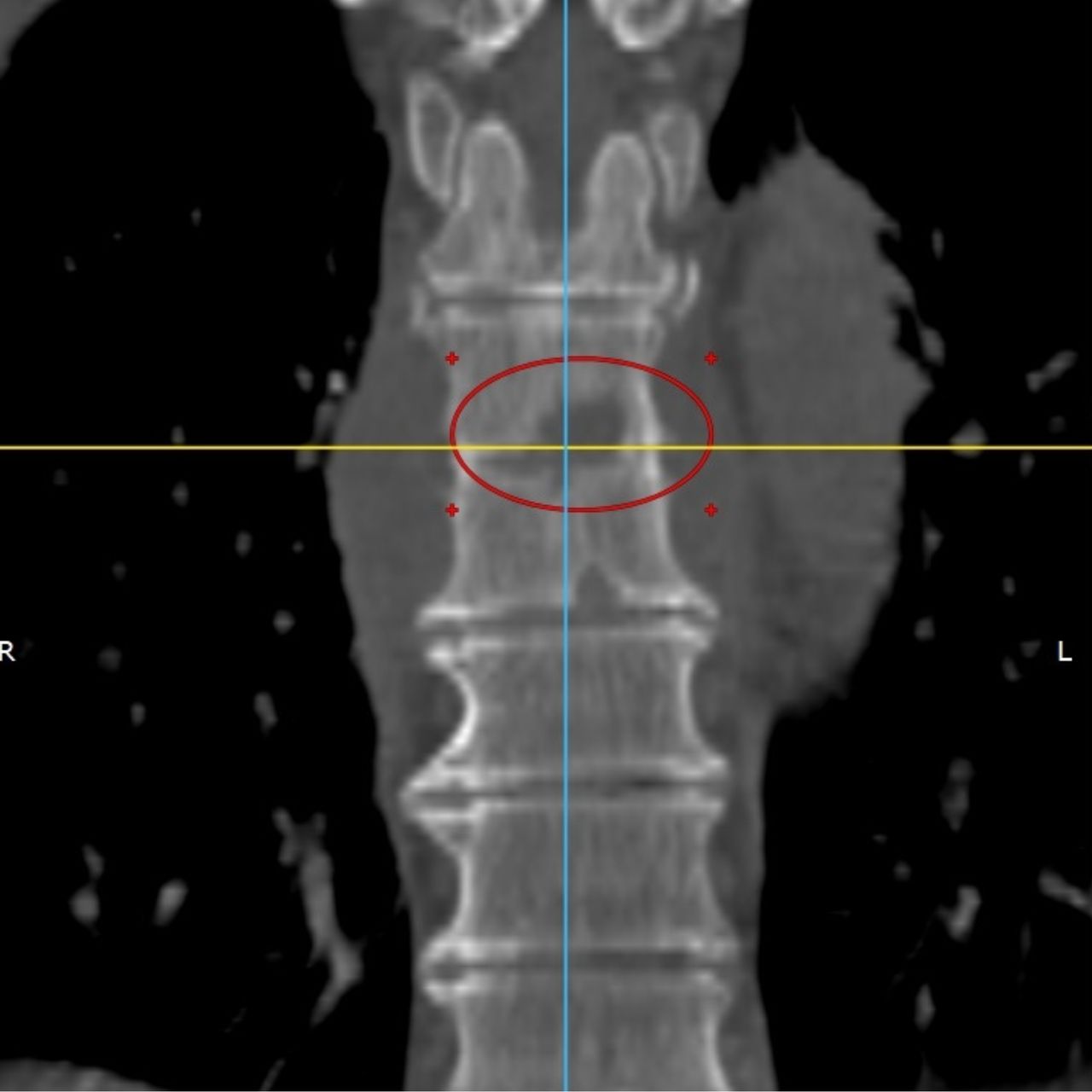 David Tafur Muñoz-2115