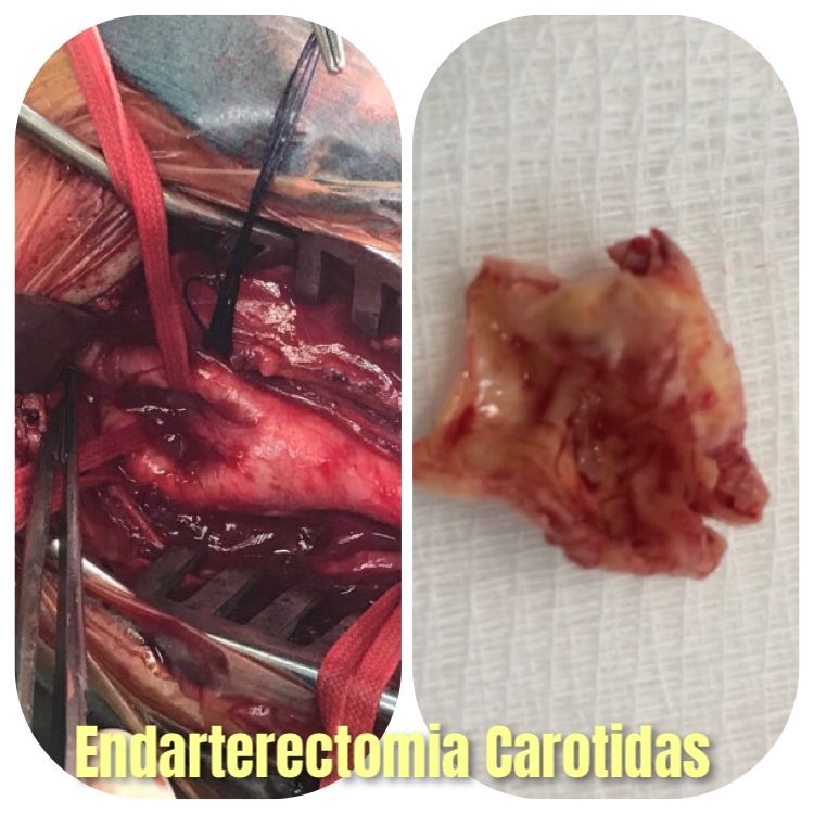 Luiz Carlos Furtat Jr-6