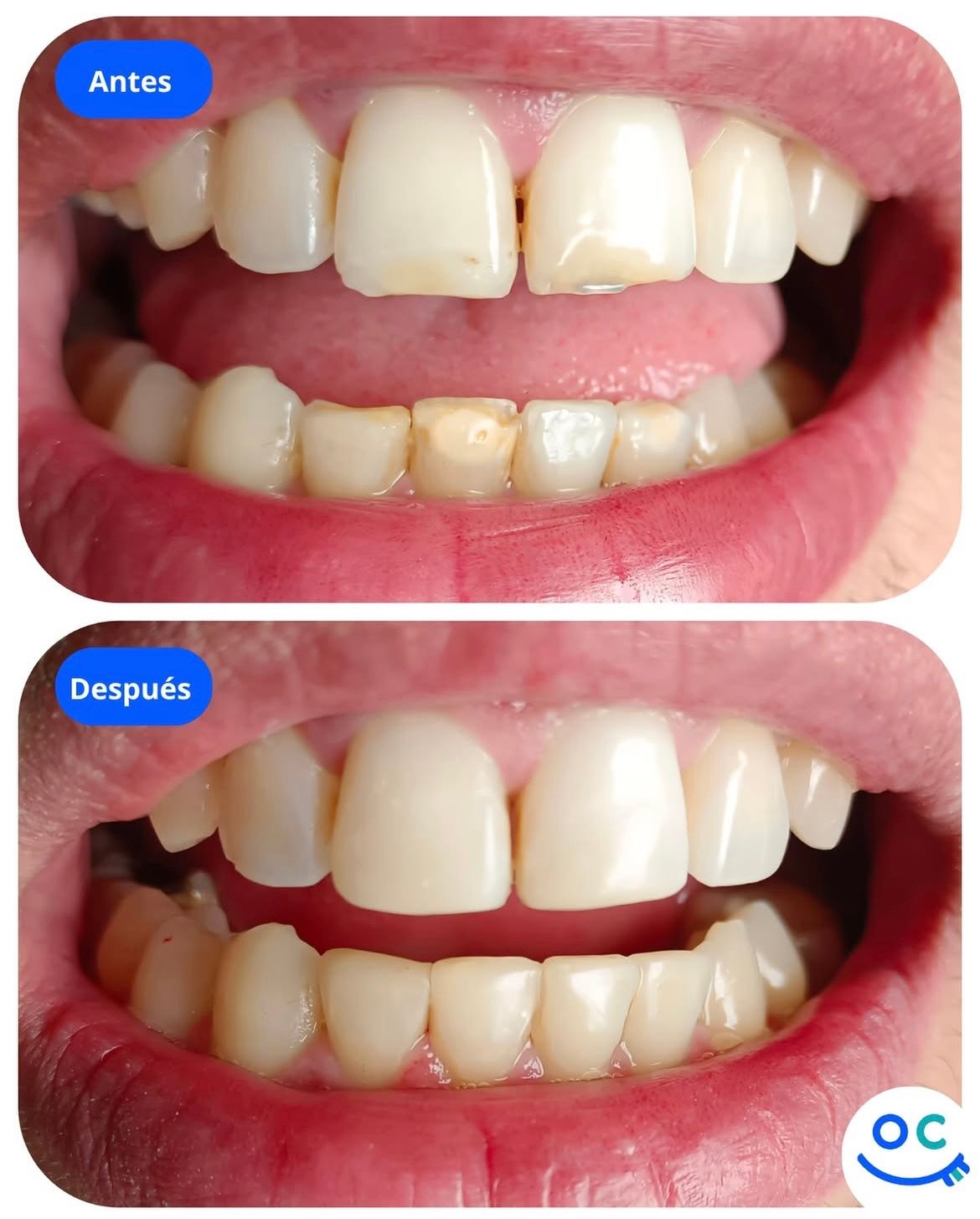 Oscar Campos Beltrán-5