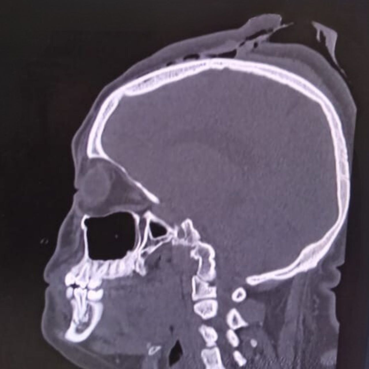 David Tafur Muñoz-1396