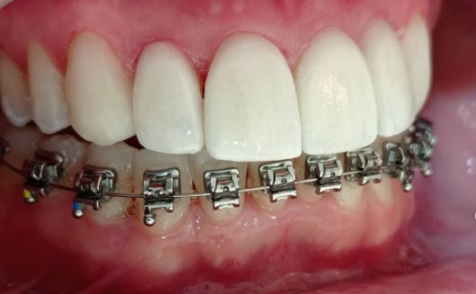 Rosemary Carneiro De Sá-47