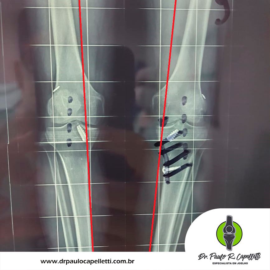 Paulo Roberto Capelletti-2