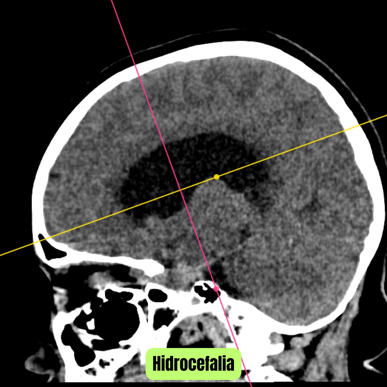 David Tafur Muñoz-1552