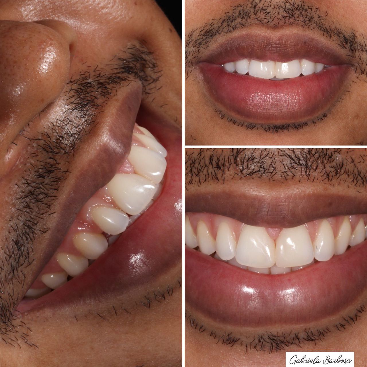 Gabriela Azevedo Barbosa-7