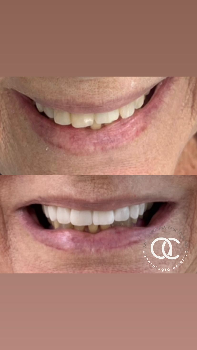 Ana Carolina Paschoalino-4