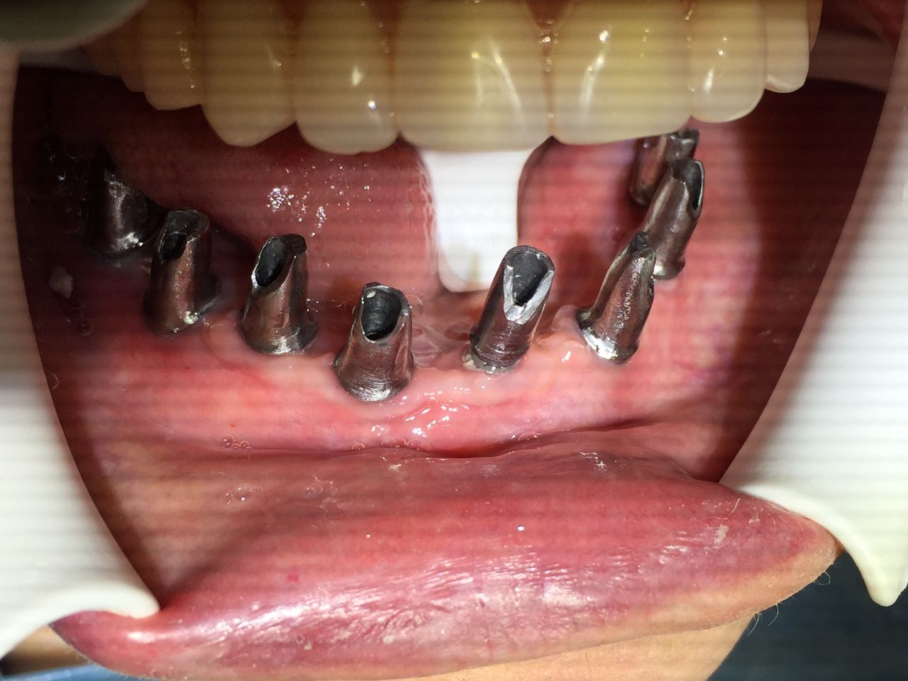 Isail Klahr Averbuch-8